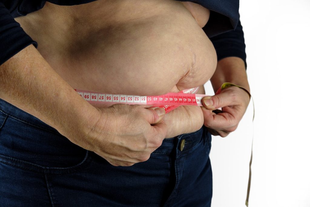 over-weight-or-obese-risk-factors